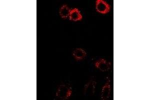 Immunofluorescent analysis of HSD17B2 staining in SW480 cells. (HSD17B2 anticorps)