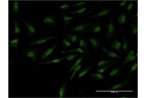 Immunofluorescence of monoclonal antibody to MYCBP on HeLa cell.