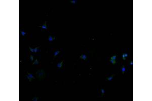Immunofluorescence staining of SH-SY5Y cells with ABIN7170135 at 1:100, counter-stained with DAPI. (SLC22A10 anticorps  (AA 37-145))