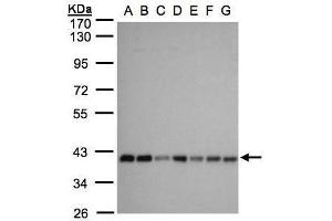WB Image Sample(30 ug whole cell lysate) A: 293T B: A431 , C: H1299 D: HeLa S3 , E: Hep G2 , F: MOLT4 , G: Raji , 10% SDS PAGE antibody diluted at 1:1000 (SLC25A33 anticorps)