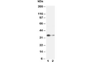 Western blot testing of Arginase 1 antibody and Lane 1:  rat liver ;  2: rat kidney lysate