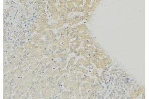 ABIN6274999 at 1/100 staining Mouse liver tissue by IHC-P. (CLN6 anticorps  (Internal Region))