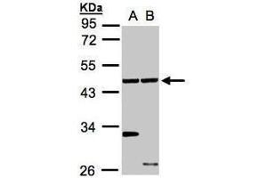WB Image Sample(30 ug whole cell lysate) A:A431, B:Hep G2 , 10% SDS PAGE antibody diluted at 1:1000 (Ethanolamine Kinase 1 anticorps)