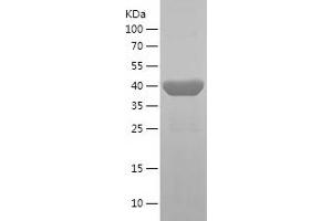 Western Blotting (WB) image for Desmin (DES) (AA 142-467) protein (His tag) (ABIN7122646) (Desmin Protein (DES) (AA 142-467) (His tag))