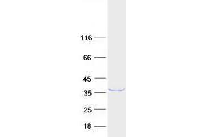 Validation with Western Blot