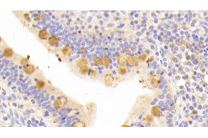 Detection of HMWK in Human Small intestine Tissue using Polyclonal Antibody to High Molecular Weight Kininogen (HMWK)