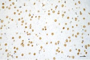 Immunohistochemistry was performed on paraffin-embedded mouse brain using TAR DNA binding protein antibody (ABIN7800512), 1:200).