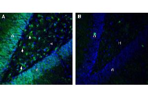 Expression of Ephrin-B2 in rat hippocampus.