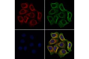 ABIN6259999 and ABIN6272243 staining Hela cells by IF/ICC.