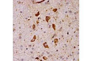 Pak7 antibody immunohistochemistry analysis in formalin fixed and paraffin embedded mouse brain tissue.