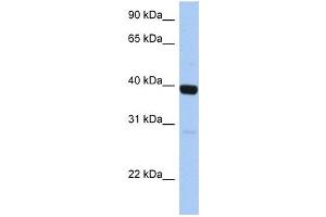 WB Suggested Anti-ZNF385B Antibody Titration:  0. (ZNF385B anticorps  (C-Term))