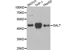 Western Blotting (WB) image for anti-Galactose-1-Phosphate Uridylyltransferase (GALT) antibody (ABIN1980308) (GALT anticorps)
