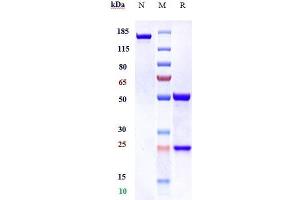 Anti-PDGFRB / CD140b Reference Antibody (rinucumab) on SDS-PAGE under reducing (R) condition.