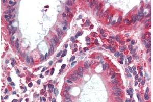 Human Colon (formalin-fixed, paraffin-embedded) stained with MYO5B antibody ABIN396915 at 20 ug/ml followed by biotinylated goat anti-rabbit IgG secondary antibody ABIN481713, alkaline phosphatase-streptavidin and chromogen. (MYO5B anticorps  (C-Term))