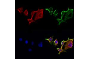 ABIN6260141 and ABIN6272955 staining Hela cells by IF/ICC.