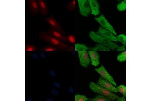 Phospho-MAFB (Ser304) Antibody staining A549 cells(H2O2 treatment) by IF/ICC. (MAFB anticorps  (pSer304))