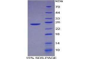 SDS-PAGE analysis of Human Caldesmon Protein. (Caldesmon Protéine)