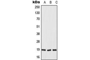 Western blot analysis of DUX5 expression in HepG2 (A), H9C2 (B), rat liver (C) whole cell lysates.