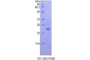 SDS-PAGE analysis of Mouse Chromobox Homolog 3 Protein.