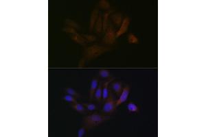 Immunofluorescence analysis of U-2 OS cells using B Rabbit mAb (ABIN1680181, ABIN7101458, ABIN7101459 and ABIN7101460) at dilution of 1:100 (40x lens). (BCAP31 anticorps)