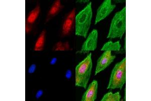 ABIN6260731 and ABIN6278203 staining  cells(UV treatment) by IF/ICC. (CDT1 anticorps  (C-Term))