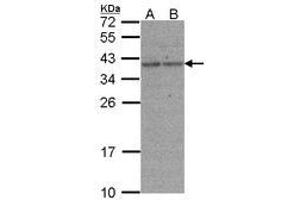Image no. 1 for anti-X-Ray Repair Complementing Defective Repair in Chinese Hamster Cells 3 (XRCC3) (AA 1-128) antibody (ABIN467379) (XRCC3 anticorps  (AA 1-128))