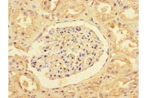 Immunohistochemistry of paraffin-embedded human kidney tissue using ABIN7170239 at dilution of 1:100 (SLC35F6 anticorps  (AA 337-371))