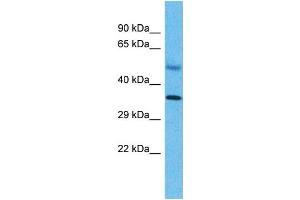 Host:  Rabbit  Target Name:  SNAPC2  Sample Type:  Liver Tumor lysates  Antibody Dilution:  1. (SNAPC2 anticorps  (C-Term))