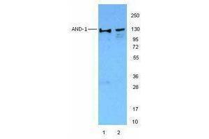 Western Blotting (WB) image for anti-WD Repeat and HMG-Box DNA Binding Protein 1 (WDHD1) antibody (ABIN2664053) (WDHD1 anticorps)