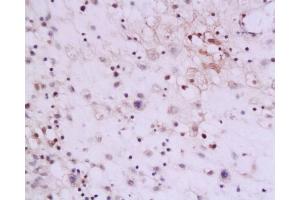 Formalin-fixed and paraffin embedded human placenta tissue labeled with Anti-IL-13 Polyclonal Antibody, Unconjugated  at 1:200, followed by conjugation to the secondary antibody and DAB staining
