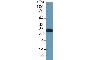 Detection of GSTa1 in Mouse Liver lysate using Polyclonal Antibody to Glutathione S Transferase Alpha 1 (GSTa1)