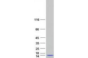 Validation with Western Blot