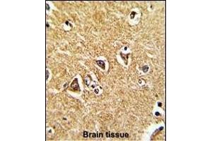 Formalin-fixed and paraffin-embedded human brain tissue reacted with mouse Prodh Antibody (Center), which was peroxidase-conjugated to the secondary antibody, followed by DAB staining.