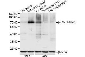 Western blot analysis of extracts of HeLa and 293T cells, using Phospho-RAF1-S621 antibody (ABIN5969931) at 1/1000 dilution. (RAF1 anticorps  (pSer621))