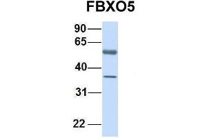 Host:  Rabbit  Target Name:  FBXO5  Sample Type:  Human Fetal Lung  Antibody Dilution:  1. (FBXO5 anticorps  (C-Term))