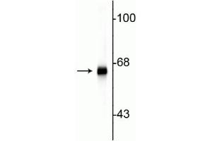 Western blot of rat cortex lysate showing specific immunolabeling of the ~ 66 kDa alpha internexin protein.