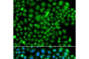 Immunofluorescence analysis of A549 cells using SUMO4 Polyclonal Antibody (SUMO4 anticorps)