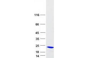 Validation with Western Blot