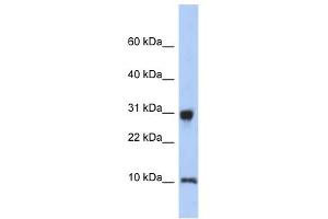 RPS21 antibody used at 1 ug/ml to detect target protein.