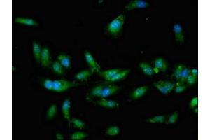 Immunofluorescent analysis of Hela cells using ABIN7148679 at dilution of 1:100 and Alexa Fluor 488-congugated AffiniPure Goat Anti-Rabbit IgG(H+L)