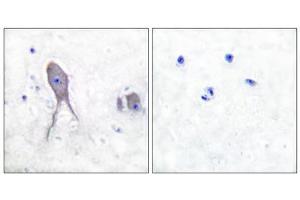 Immunohistochemical analysis of paraffin-embedded human brain tissue, using Notch 2 (cleaved-Asp1733) antibody. (NOTCH2 anticorps  (Cleaved-Asp1733))