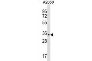 Western Blotting (WB) image for anti-Olfactory Receptor, Family 2, Subfamily T, Member 35 (OR2T35) antibody (ABIN3000665) (OR2T35 anticorps)
