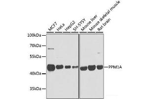 Western blot analysis of extracts of various cell lines using PPM1A Polyclonal Antibody at dilution of 1:1000. (PPM1A anticorps)