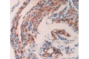 IHC-P analysis of Mouse Ovary Tissue, with DAB staining. (GAS6 anticorps  (AA 483-646))
