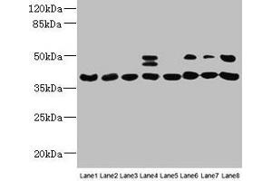 Western blot All lanes: HIF1AN antibody at 12 μg/mL Lane 1: Mouse heart tissue Lane 2: Mouse skeletal muscle tissue Lane 3: K562 whole cell lysate Lane 4: MCF-7 whole cell lysate Lane 5: HL60 whole cell lysate Lane 6: 293T whole cell lysate Lane 7: Jurkat whole cell lysate Lane 8: A375 whole cell lysate Secondary Goat polyclonal to rabbit IgG at 1/10000 dilution Predicted band size: 41 kDa Observed band size: 41, 48 kDa (HIF1AN anticorps  (AA 2-254))