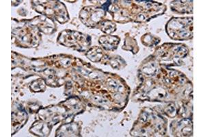 The image on the left is immunohistochemistry of paraffin-embedded Human placenta tissue using ABIN7130075(LEPREL2 Antibody) at dilution 1/50, on the right is treated with fusion protein. (LEPREL2 anticorps)