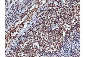 Image no. 2 for anti-V-Akt Murine Thymoma Viral Oncogene Homolog 1 (AKT1) antibody (ABIN1496557) (AKT1 anticorps)