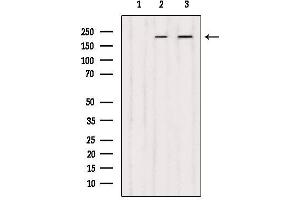 Western blot analysis of extracts from various samples, using DOCK1 Antibody. (DOCK1 anticorps  (C-Term))