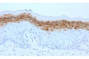 Immunohistochemical staining (Formalin-fixed paraffin-embedded sections) of human skin with FLG monoclonal antibody, clone FLG/1561 . (Filaggrin anticorps  (AA 998-1104))