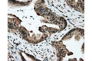 Image no. 2 for anti-Amyloid beta (A4) Precursor Protein (APP) antibody (ABIN1496877) (APP anticorps)